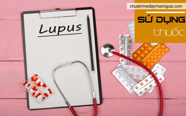 bị bệnh lupus ban đỏ 