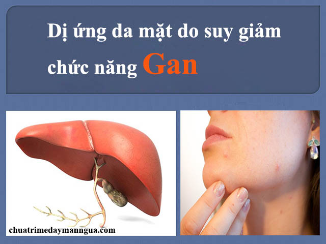 Nguyên nhân dị ứng da do gan