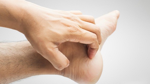 Ngứa tay chân về đêm do lupus ban đỏ