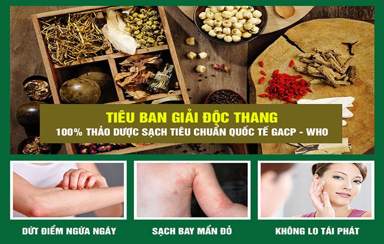 Bài thuốc Tiêu ban giải độc thang chữa mề đay mẩn ngứa