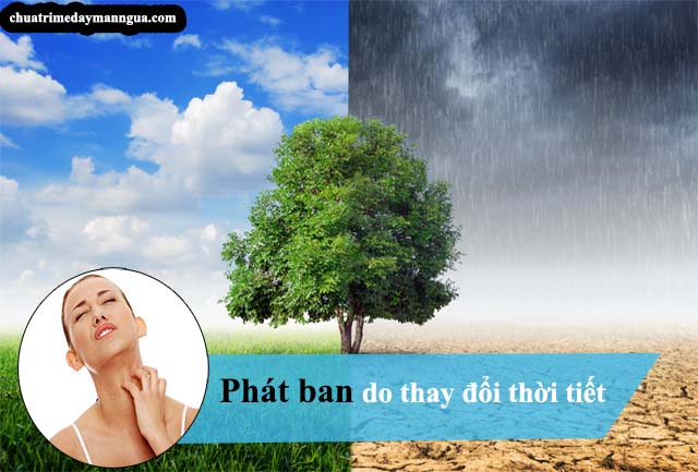 Phát ban do thời tiết