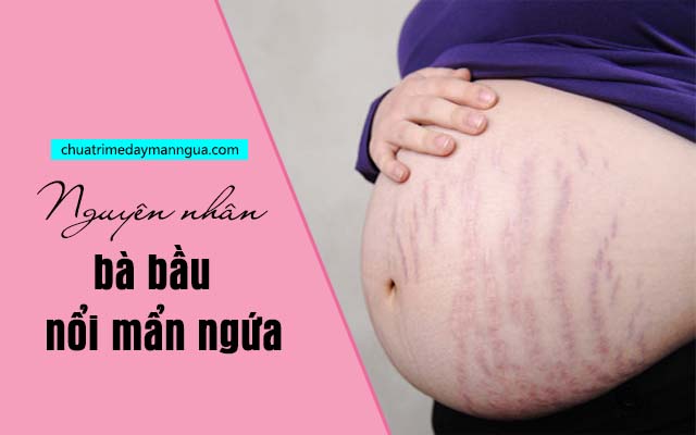 bà bầu nổi mẩn ngứa 