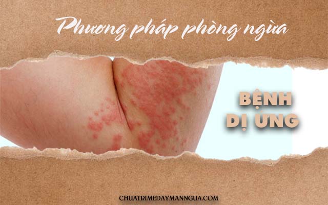 cách phòng ngừa bệnh dị ứng 