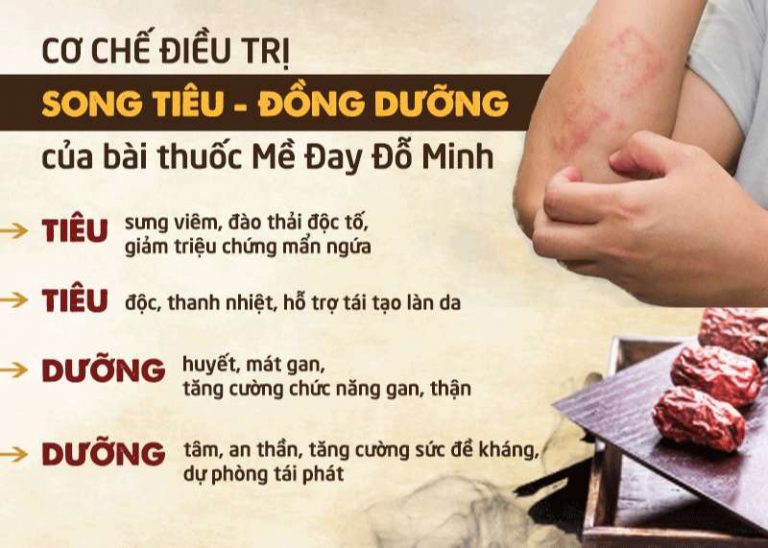 Cơ chế trị bệnh SONG TIÊU ĐỒNG DƯỠNG của bài thuốc Mề đay Đỗ Minh