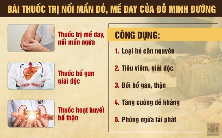 Mề đay Đỗ Minh - phương thuốc gia truyền dòng họ Đỗ Minh điều trị tình trạng da vẽ nổi