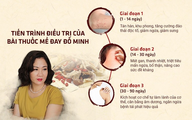 DV Nguyệt Hằng tin tưởng điều trị mề đay tại nhà thuốc nam Đỗ Minh Đường